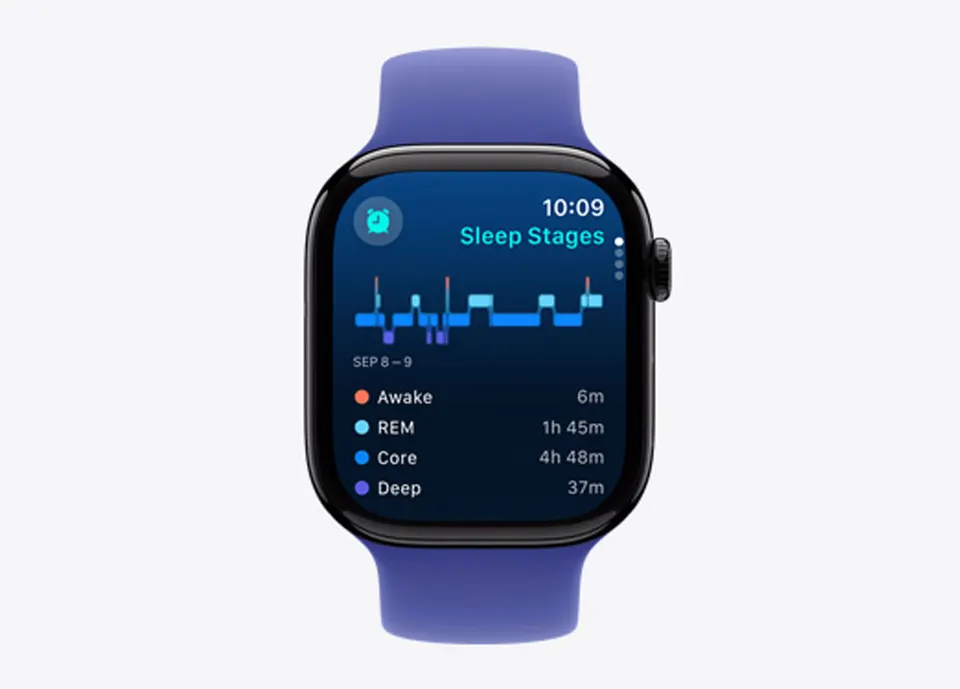 Смарт-часы Apple Watch S10 42mm Cellular (10)