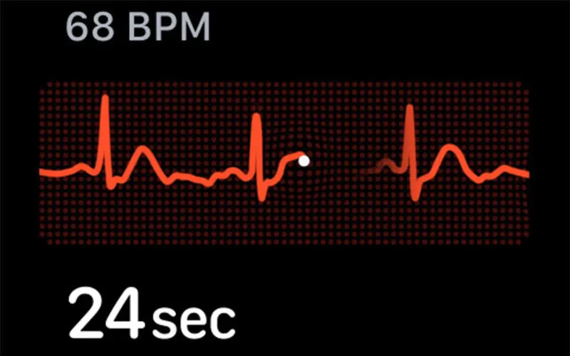 Смарт-часы Apple Watch Series 9 GPS 45mm (9)