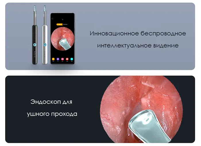Эндоскоп для удаления ушной серы (Bebird R1) (6)