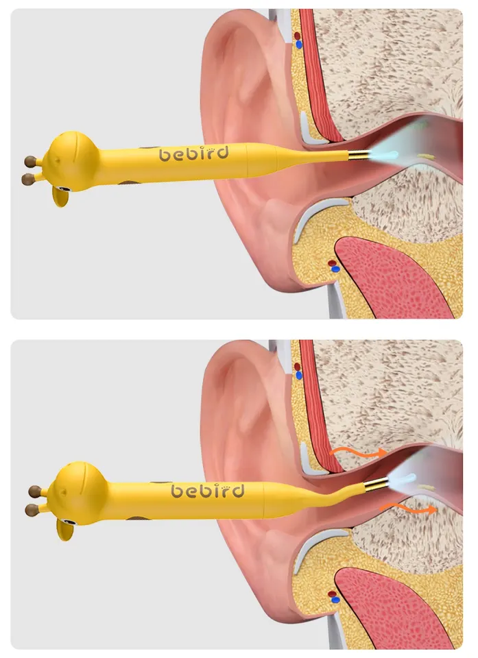Умный очиститель для ушей Xiaomi Bebird Smart Visual Ear Cleaner D3 Pro (2)
