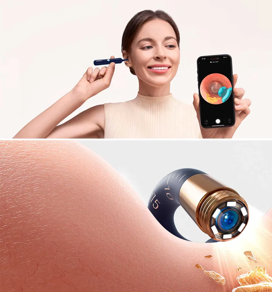Эндоскоп для удаления ушной серы Bebird D39R (3)