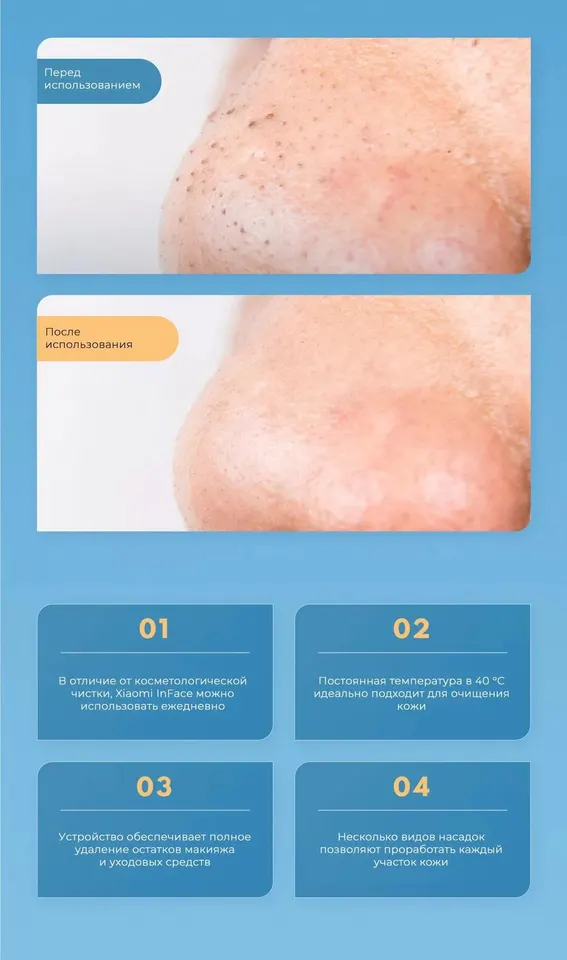 Аквапилинг для лица Xiaomi InFace Thermal Aqua Peel Facial Device (3)